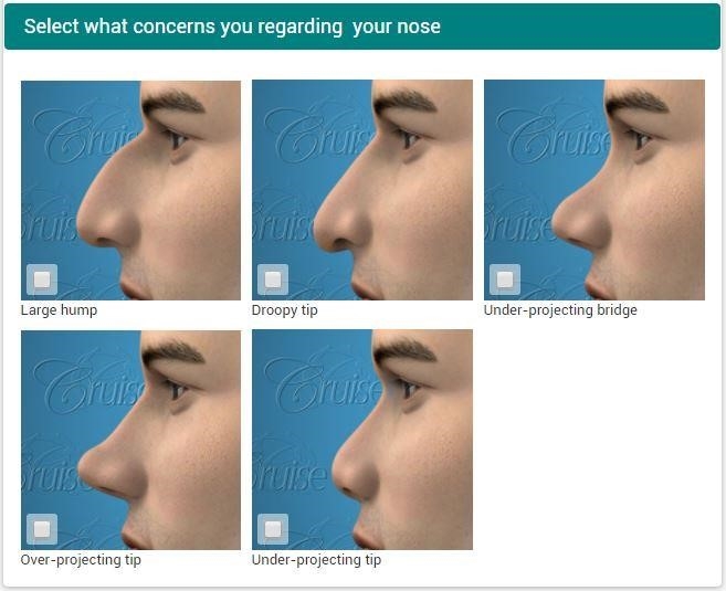 rhinoplasty surgery near me